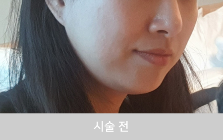 before_Img